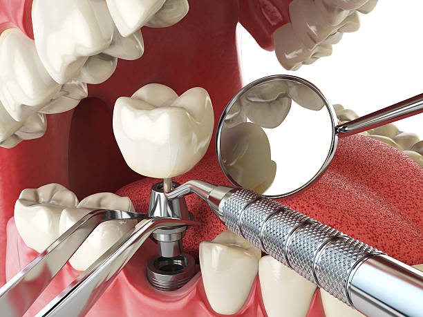 Best Emergency Treatment for Oral Infections in Panaca, NV
